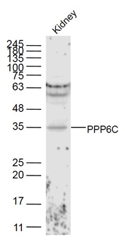 PPP6C Rabbit Polyclonal Antibody
