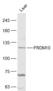 PRDM10 Rabbit Polyclonal Antibody