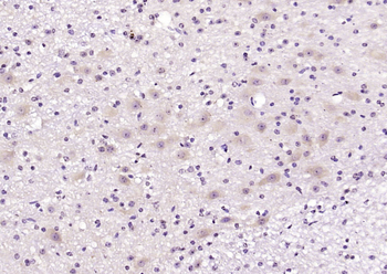 PAM16 Rabbit Polyclonal Antibody