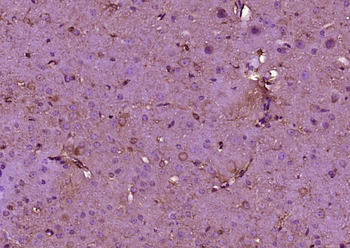 PAN3 Rabbit Polyclonal Antibody