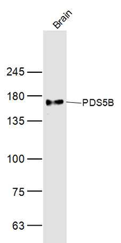 PDS5B Rabbit Polyclonal Antibody