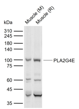 PLA2G4E Rabbit Polyclonal Antibody