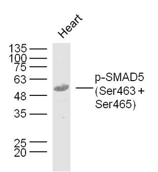 Phospho-SMAD5 (Ser463 + Ser465) Rabbit Polyclonal Antibody