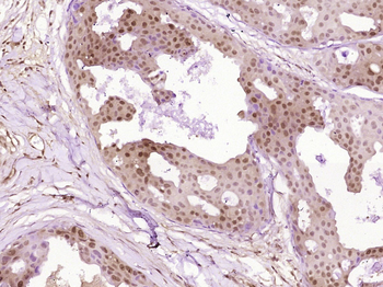 SMARCA5 Rabbit Polyclonal Antibody