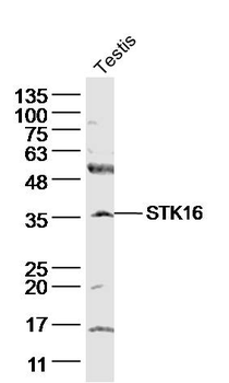 STK16 Rabbit Polyclonal Antibody