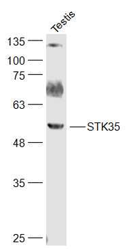 STK35 Rabbit Polyclonal Antibody