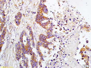 TIMP-1 Rabbit Polyclonal Antibody