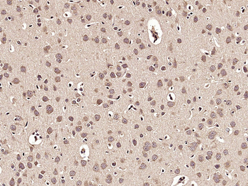 TREM2 Rabbit Polyclonal Antibody
