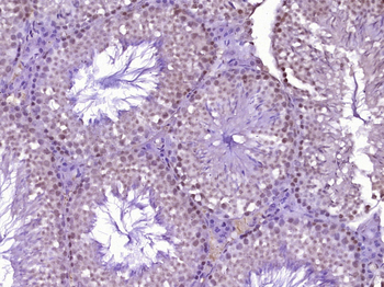 RUVBL1 Rabbit Polyclonal Antibody