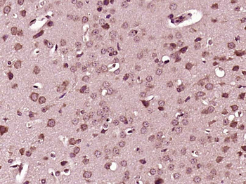 VAC14 Rabbit Polyclonal Antibody