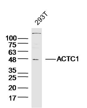 ACTC1 Rabbit Polyclonal Antibody