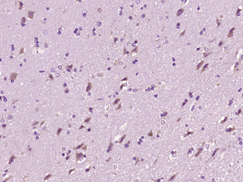 Fibrinopeptide B Rabbit Polyclonal Antibody