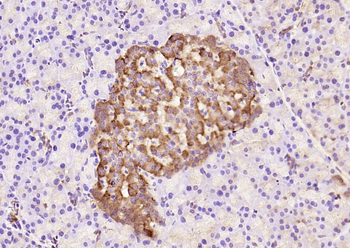 Phospho-IRS1 (Tyr632) Rabbit Polyclonal Antibody