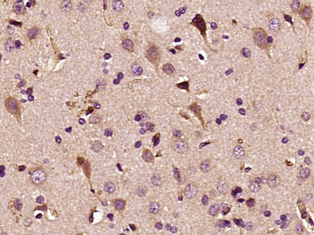 ITCH/AIP4 Rabbit Polyclonal Antibody