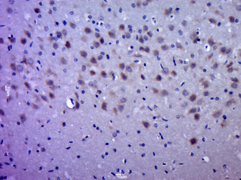 QPRT/QAPRTase Rabbit Polyclonal Antibody