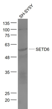 SETD6 Rabbit Polyclonal Antibody