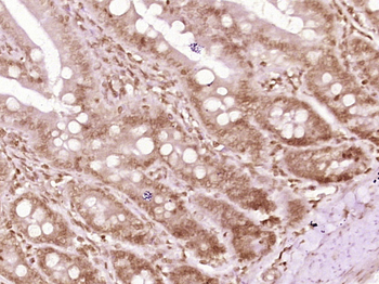 SH3BGRL3 Rabbit Polyclonal Antibody