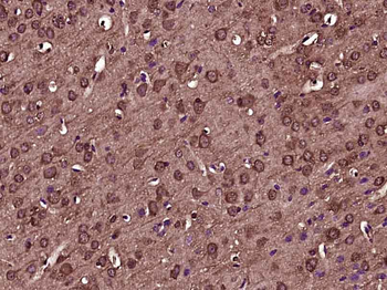 Tissue factor Rabbit Polyclonal Antibody