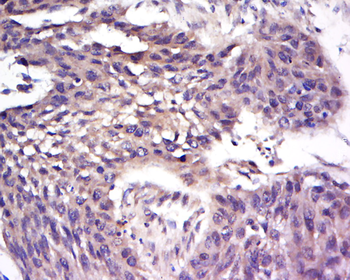 AHR Rabbit Polyclonal Antibody