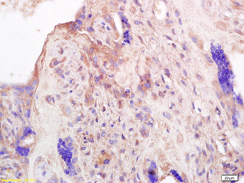 PRL Rabbit Polyclonal Antibody