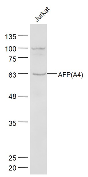 AFP Mouse Monoclonal Antibody