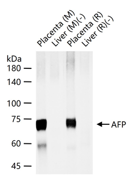 AFP Mouse Monoclonal Antibody