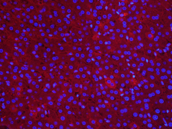 AFP Mouse Monoclonal Antibody