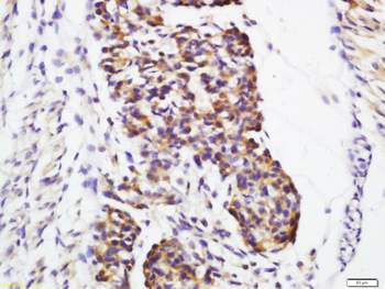 Galectin 1 Rabbit Polyclonal Antibody