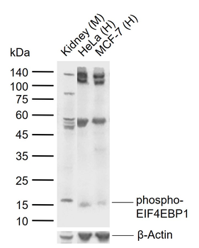 Phospho-EIF4EBP1 (Ser111) Rabbit Polyclonal Antibody