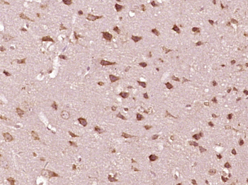 Phospho-Stat2 (Tyr690) Rabbit Polyclonal Antibody
