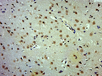 Phospho-APC1 (Ser377) Rabbit Polyclonal Antibody
