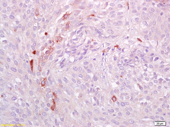 Phospho-AXL (Tyr698+Tyr702+Tyr703) Rabbit Polyclonal Antibody