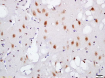 Phospho-TNIK (Ser764) Rabbit Polyclonal Antibody