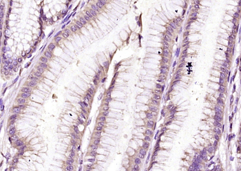 GEF H1 Rabbit Polyclonal Antibody