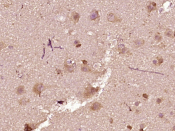 Phospho-BAD (Ser75) Rabbit Polyclonal Antibody