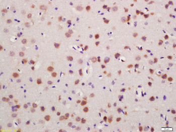 Glutamine synthetase Rabbit Polyclonal Antibody