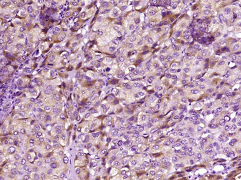 BCL10 Rabbit Polyclonal Antibody