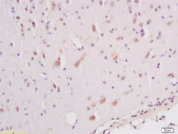Phospho-B-Raf (Ser602) Rabbit Polyclonal Antibody