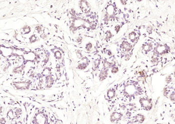 Phospho-BRCA1 (Ser1189) Rabbit Polyclonal Antibody