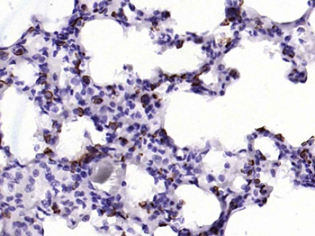 MUC1 Rabbit Polyclonal Antibody