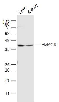 AMACR Mouse Monoclonal Antibody (HRP)