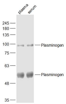 Plasminogen Rabbit Polyclonal Antibody (HRP)