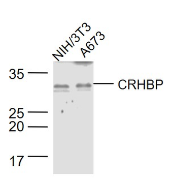 CRHBP Rabbit Polyclonal Antibody (HRP)