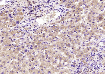 Ceruloplasmin Rabbit Polyclonal Antibody