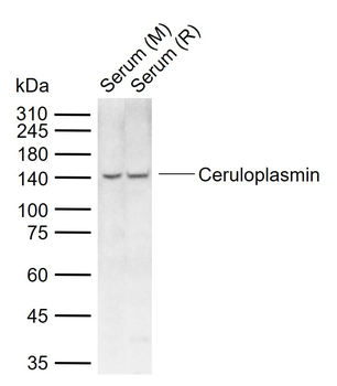 Ceruloplasmin Rabbit Polyclonal Antibody