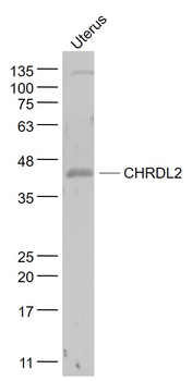 CHRDL2 Rabbit Polyclonal Antibody