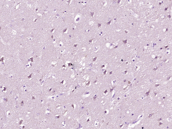 Coxsackie Adenovirus Receptor Rabbit Polyclonal Antibody