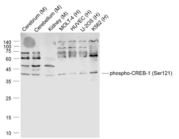 Phospho-CREB-1 (Ser121) Rabbit Polyclonal Antibody
