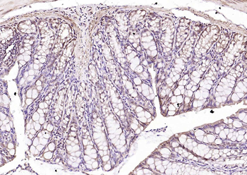CREM Rabbit Polyclonal Antibody