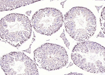CREM Rabbit Polyclonal Antibody